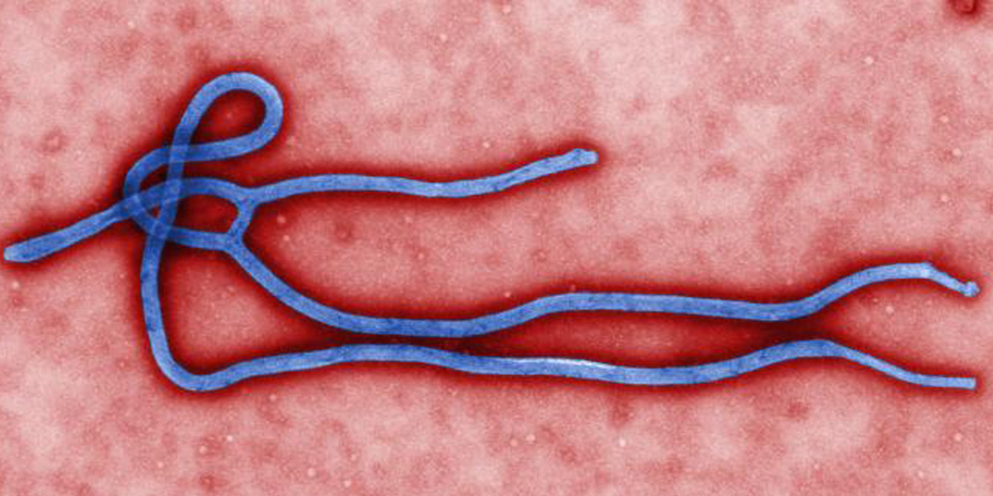 Ebola-CDC brief