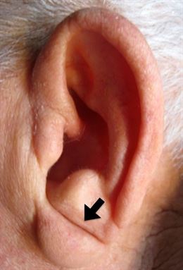 oreja