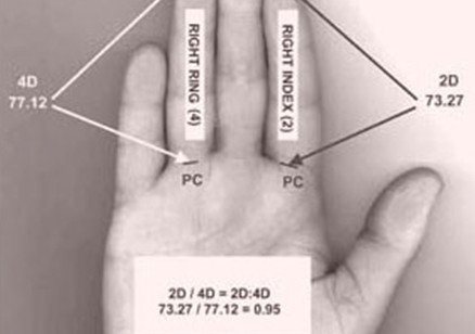 Digit ratio