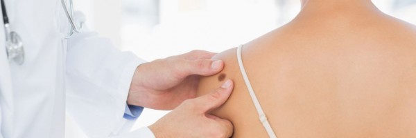 Doctor examining melanoma on woman