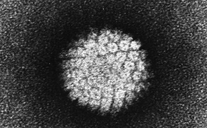 virus del papiloma humano (VPH)