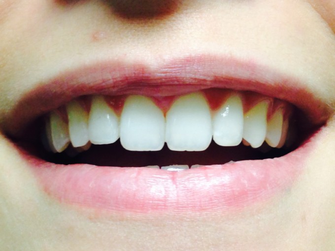 SONRISA-BOCA-DIENTES