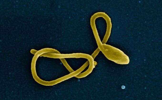 particula virus ebola