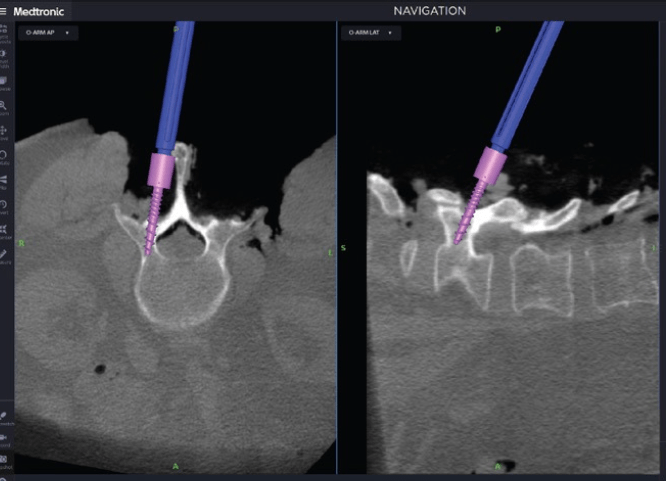 imagen neuronavegador2