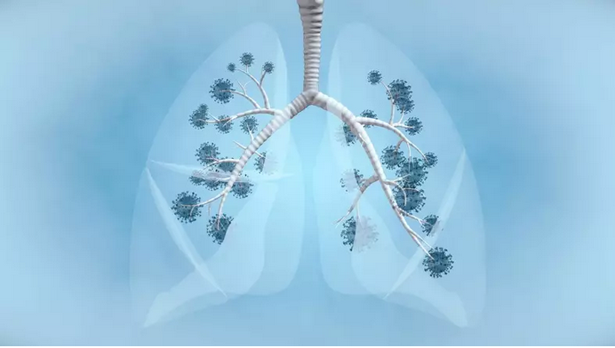 Covid-19 en el pulmón coronavirus