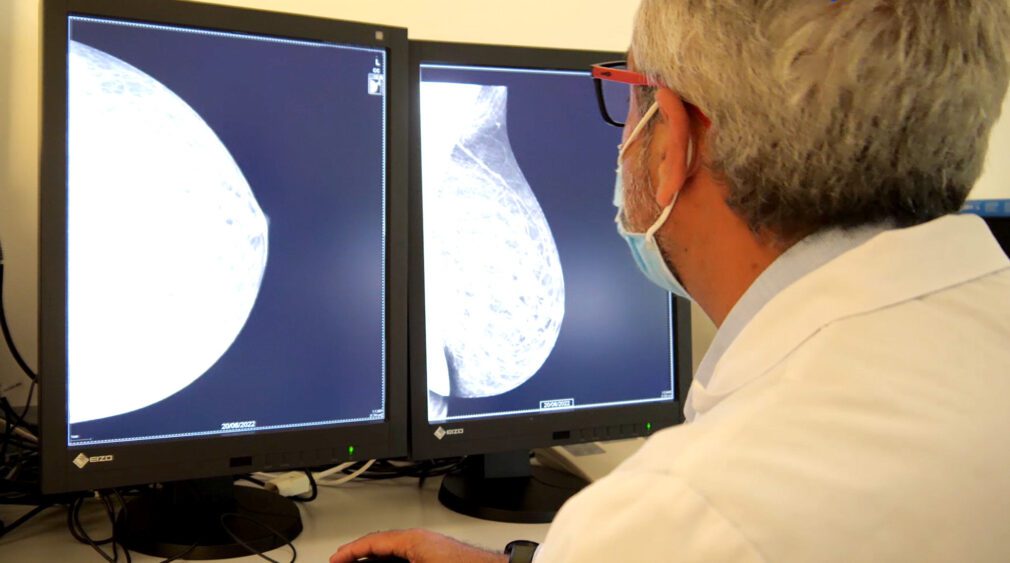 Especialista de Vithas revisando una mamografía