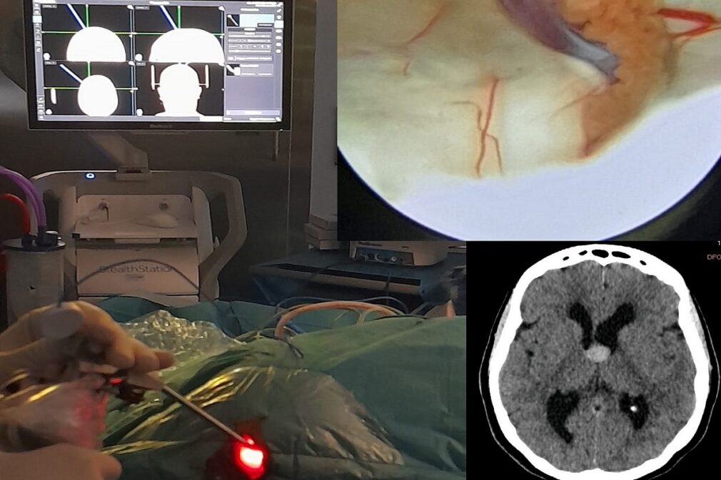 endoscopia (1)