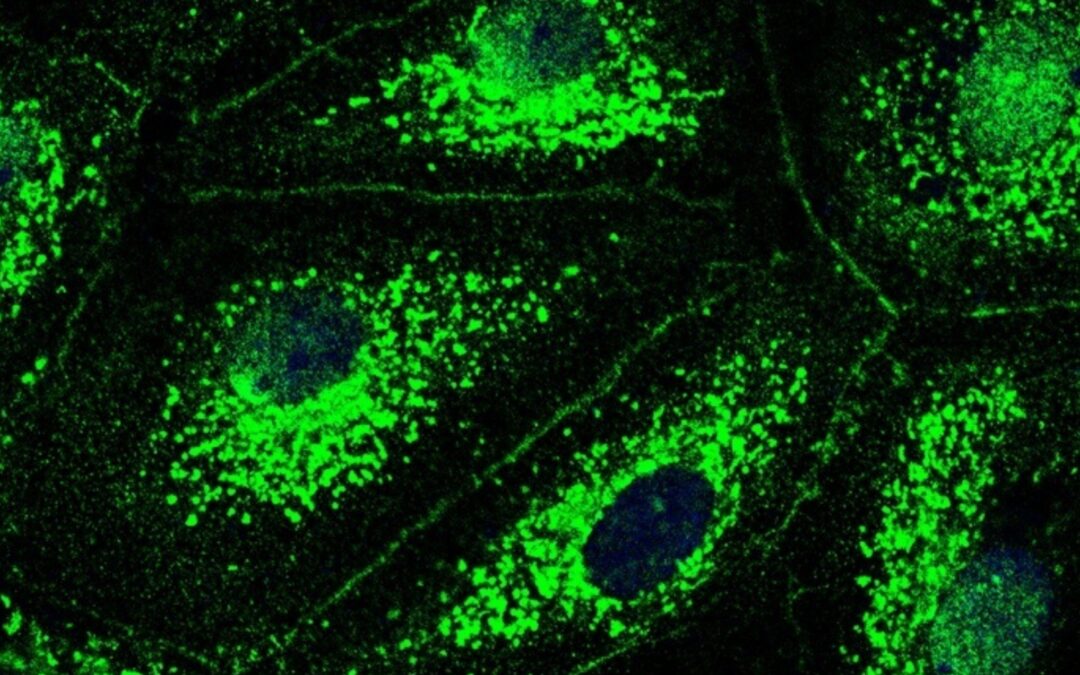 'Salud a todo Twitch' analiza este miércoles la fibrosis quística